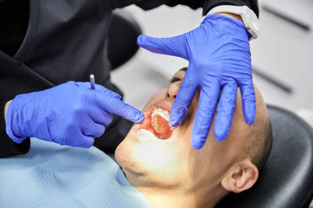 Best Emergency Dentist for Knocked-Out Tooth in Park Hills, MO