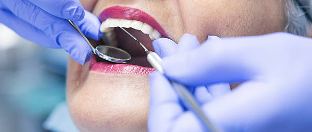 Best Emergency Dentist for Lost Fillings or Crowns in Park Hills, MO